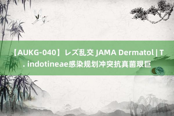 【AUKG-040】レズ乱交 JAMA Dermatol | T. indotineae感染规划冲突抗真菌艰巨